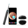 Xiaomi Bebird M9 Pro Earwax Endoscope Ear Cleaner